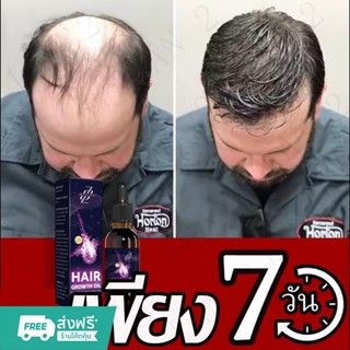 【ปลูกผมเร็ว】เซรั่มปลูกผม น้ำยาปลูกผมดก น้ำยาเร่งผมยาว ยาปลูก…