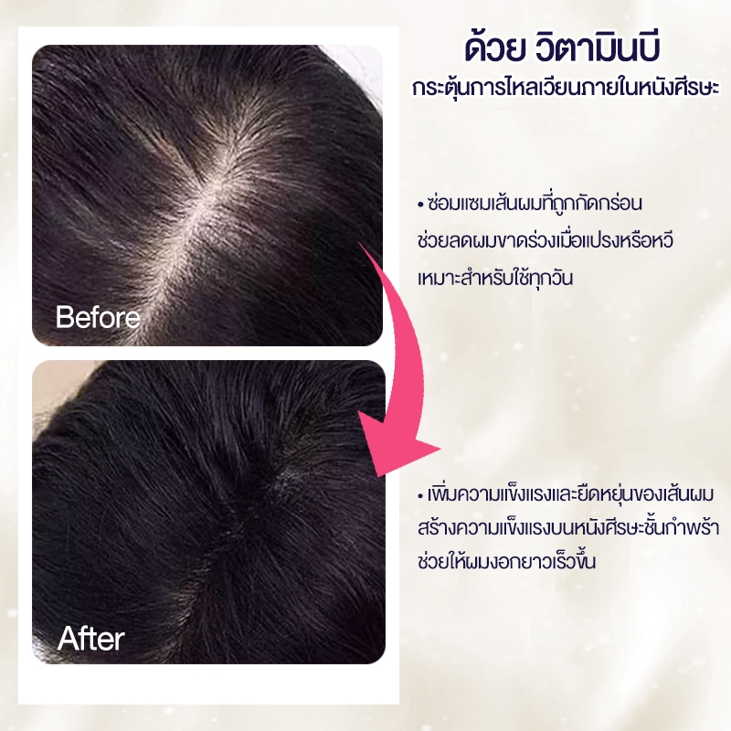 [แพ็คสุดคุ้ม 1100ml ！] Cokki แชมพู 900 มล+ มินิ 2 ขวด（100ml）แชมพูป้องกันผมร่วง ปกป้องผมขาดหลุดร่วง - รูปที่ 2