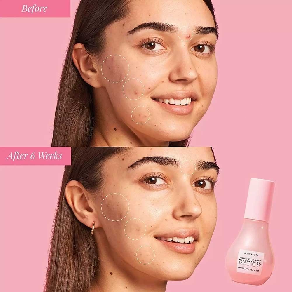 Essence-GLOW RECIPE เซรั่ม Watermelon Glow Niacinamide Dew Drops