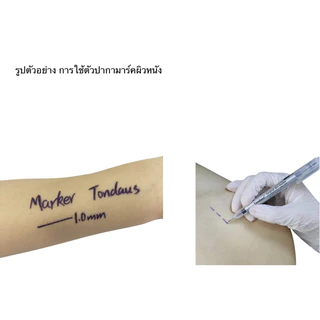 ปากกามาร์คผิวหนัง !!แถมฟรีไม้บรรทัด🆓 Tondaus Skin marker สำหรับผ่าตัด และศัลยกรรม ราคาต่อ ปากกา 1 ✅คุณภาพใช้ในโรงบาล