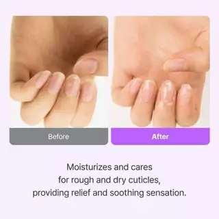 BAREN - Nail & Cuticle Care Essence Oil Pen 2 ml. บาเรน เนล & คิวติเคิล แคร์ เอสเซ้นซ์ ออยล์ เพ็น