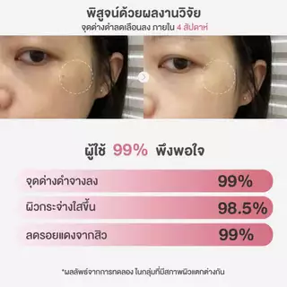 เลอสกิน แลป อินเทนซ์ ไนอะซินาไมด์ 15% ขนาด 30 มล. หน้าขาวใส ฉ่ำเงา ลดรอยแดง รอยด