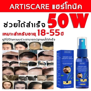 บอกลาหัวล้าน EELHOE สเปรย์ปลูกผม ยาปลูกผม เร่งผมขึ้นใหม่ เร่งผมยาวไว ป้องกันผมร่วง น้ำยาปลูกผม