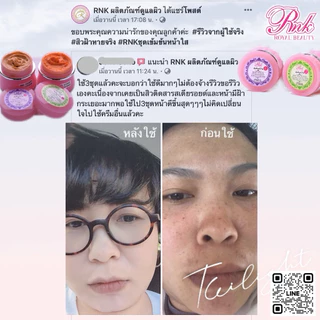 RNKครีมชุดเข้มข้นหน้าใส2กระปุกก่อนนอน