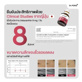 [ช้อปครบ รับฟรี] Dr.PONG Astaxanthin 6 mg AstaREAL ชะลอริ้วรอย ลดจุดด่างดำ ดอกเตอร์พงศ์ เนเชอรัล แอสตาแซนธิน 6 มก