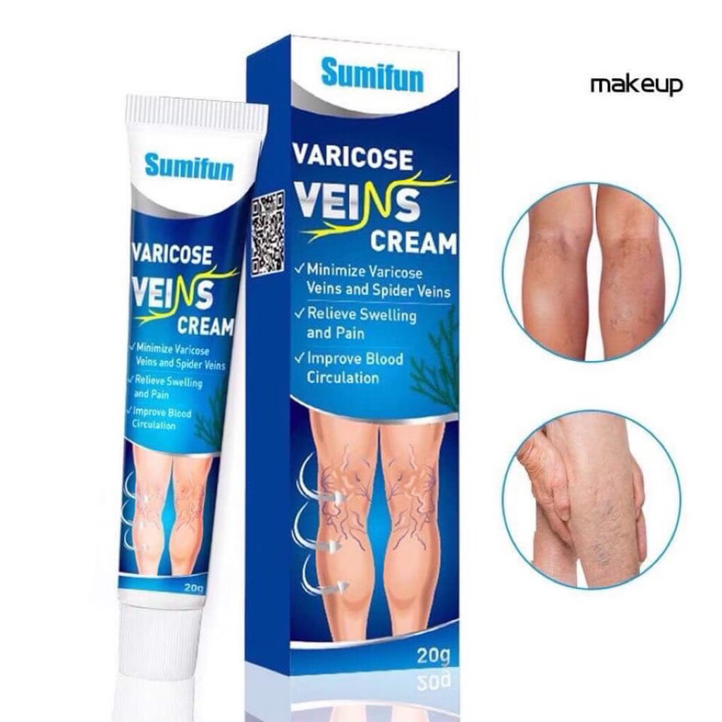 Varicose Veins Cream ครีมทาเส้นเลือดขอด Sumifun ขนาด 20 กรัม