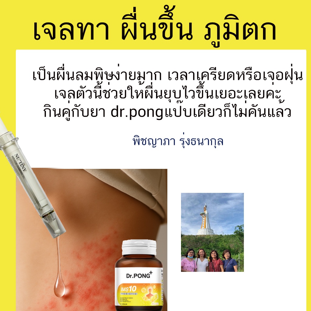 เจลทาผื่นผื่นแพ้อากาศ pantip แพ้อากาศเย็น ผื่นคัน วิธีแก้ ลักษณะผื่นแพ้อากาศ ผื่นแพ้อากาศเย็น