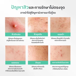 NU FORMULA Acne Solution Ampoule Serum 30ml เซรั่มดูแลปัญหาสิว BHA 2% ลดรอยแดง รอยสิว รอยดำจากสิว