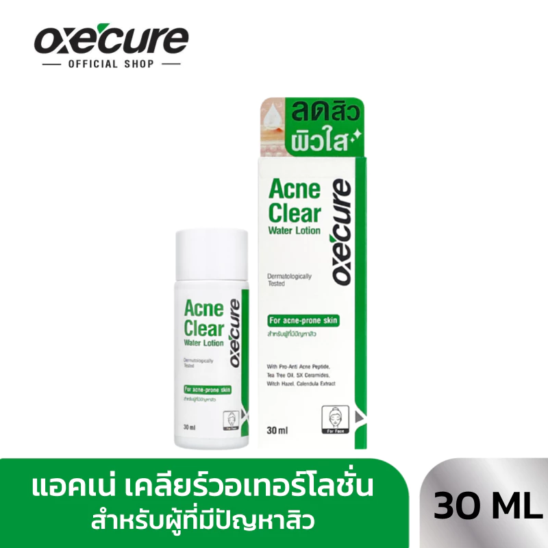 Oxe'cure Acne Clear Water Lotion 30 ml อ๊อกซีเคียว แอคเน่ เคลียร์วอเทอร์โลชั่น (10OX00160)
