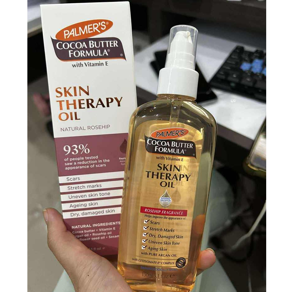 Palmer's Skin Therapy Oil 150 ml.ปาล์มเมอร์ ออย ป้องกันและลดรอยแตกลาย จางลงภายใน 2 เดือน ขนาด 150 มล.