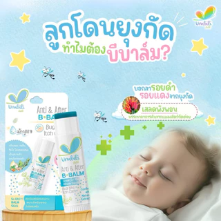 (ส่งด่วน⚡️ไม่มีวันหยุด) Umbili โลชั่นกันยุง สเปรย์กันยุง ทาหลังยุงกัด โบบันไซ กลิ่นหอม สำหรับเด็ก อ่อนโยนต่อผิวเด็ก