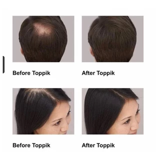 ส่งToppikแน่นอน 💋 สีดำ ผงไฟเบอร์ปิดผมบาง ผงไฟเบอร์ ผงโรยผม ผงไฟเบอร์ผม ผงโรยผมหนา ผงไฟเบอร์ใส่ผม