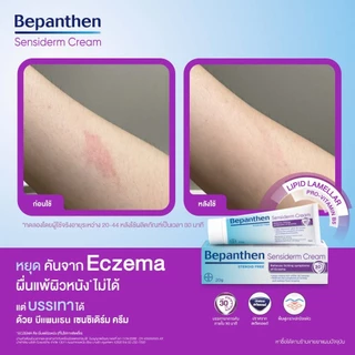 Bepanthen Sensiderm บีแพนเธน เซนซิเดิร์ม ครีมบรรเทาอาการคันและแดง จากการระคายเคืองผิว / 20 กรัม