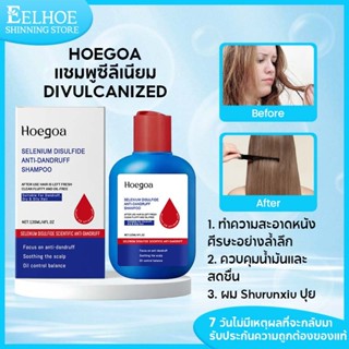 【1แถม1】Hoegoa ซีลีเนียมซัลไฟด์แชมพูขจัดรังแค แชมพูรังแค แชมพ…