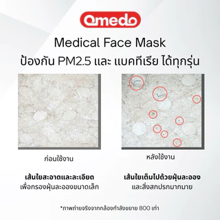 [Official Store] Omedo V-face Medical Face Mask มอก.ระดับที่ 1 ทรงวีเฟซ สีขาว บรรจุ 30 ชิ้น