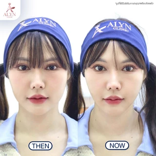 Ultraformer III ทำครั้งเดียว เห็นผลทันที + รับฟรี Fat หรือ Hifu Premium