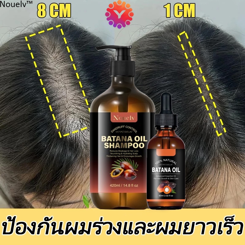 Nouelv batanaoil แชมพูป้องกันผมร่วง420ml สาระสำคัญของสมุนไพร บำรุงรากผม หยุดผมร่วงและเร่งผมงอกใหม่ แชมพูปลูกผม แชมพูแก้ผ