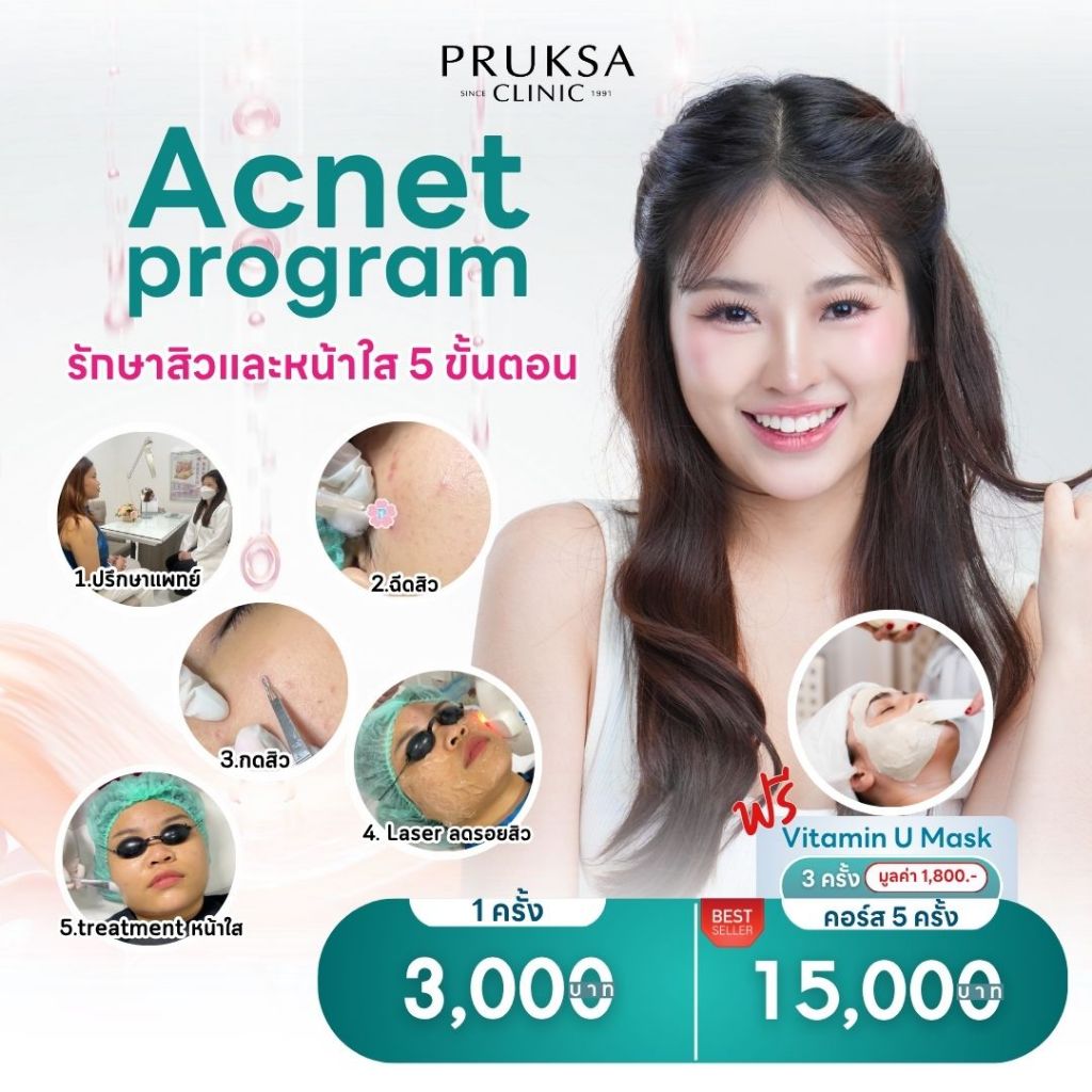 Acnet Program รักษาสิว 5 ขั้นตอน