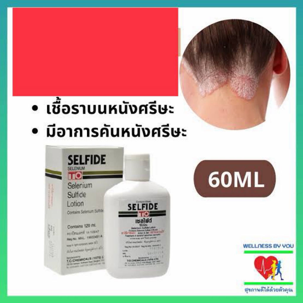 เซล  ฟาย น้ำยารังแคแก้คัน 60,120ml หยุดอาการค้น