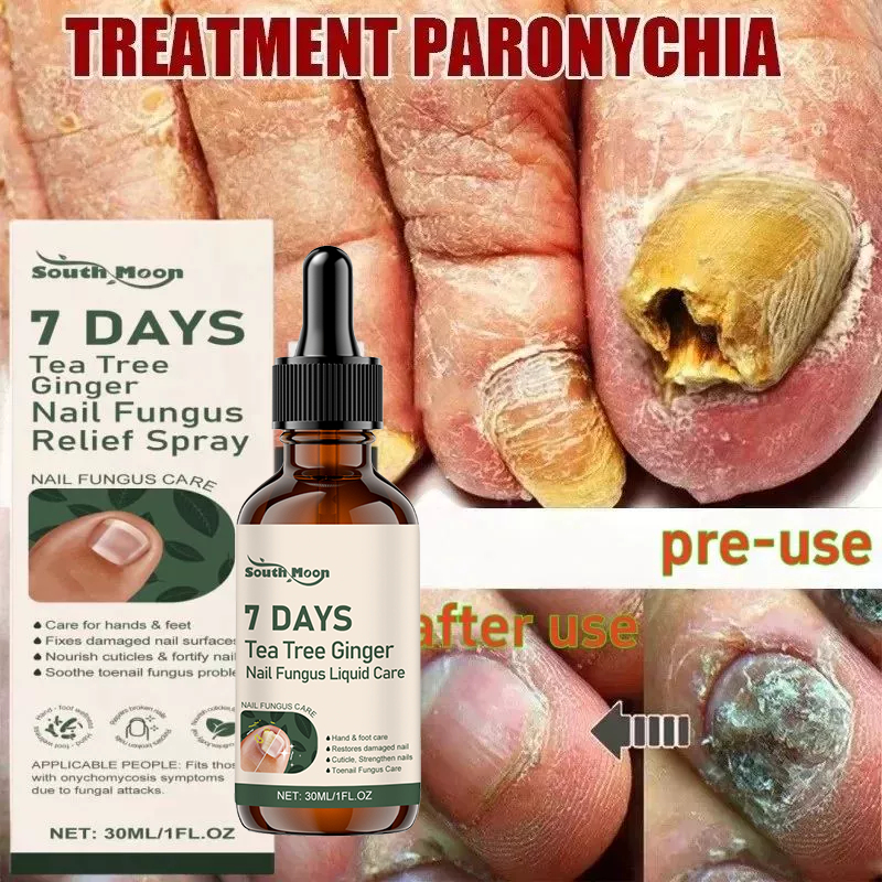 ✨ฆ่าเชื้อราได้ผลใน 7 วัน⏱️ใช้ง่าย แห้งเร็ว ไม่เหนอะหนะ เร่งการงอกของเนื้อเล็บใหม่ - รูปที่ 2