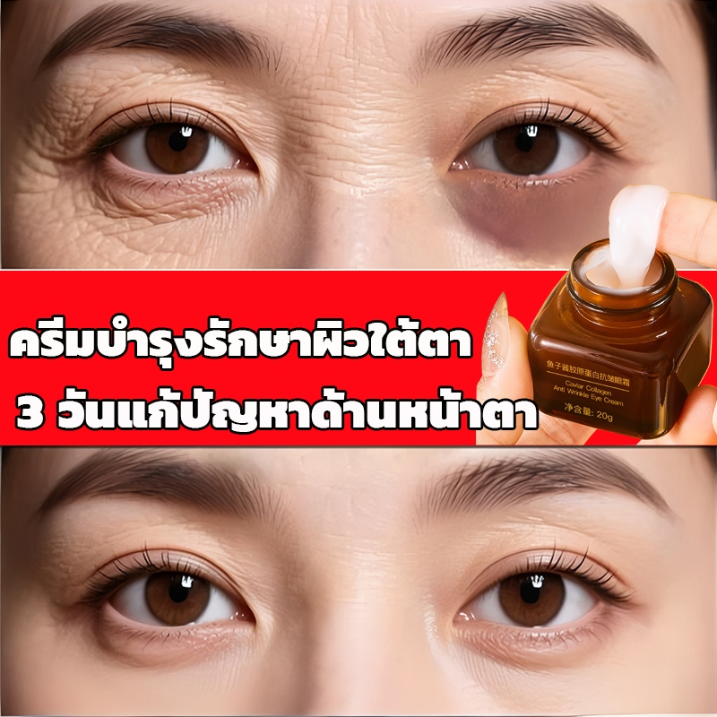 【ของแท้ พร้อมส่ง】ครีมบำรุงรอบดวงตา 20G ดูแลรอบดวงตาและ ครีมลดถุงใต้ตา ลดรอยคลำ้ใต้ตาลด ริ้วรอย