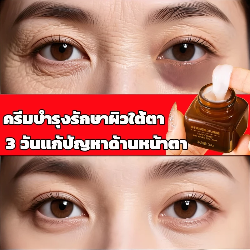【ของแท้ พร้อมส่ง】ครีมบำรุงรอบดวงตา 20G ดูแลรอบดวงตาและ ครีมลดถุงใต้ตา ลดรอยคลำ้ใต้ตาลด ริ้วรอย