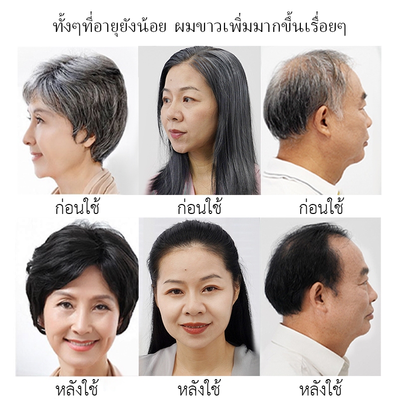 ✅Mall [แชมพูปิดผมขาว] SAFEMILD แชมพูบำรุงผมจากสมุนไพรธรรมชาติ 300 กรัม ช่วยดูแลและทำความสะอาดเส้นผม ผมร่วง ผมบาง - รูปที่ 2