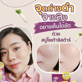 [ซอง] ซิสต้าร์ แรดิช เพอร์เฟค ไวท์ แอนด์ สมูท โซป Sistar Radish Perfect White & Smooth Soap 60 กรัม