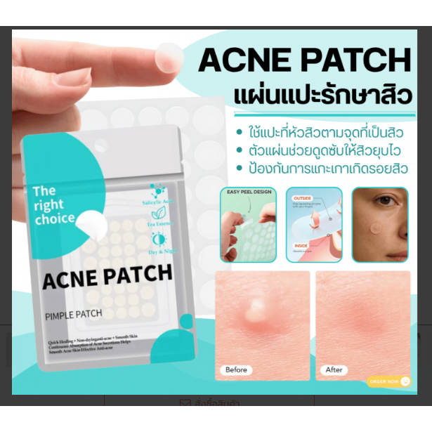 West month acne pimple sticker แผ่นแปะรักษาสิว-1 ซองบรรจุ 36แผ่น(มี 2 ขนาดเล็กและใหญ่ )