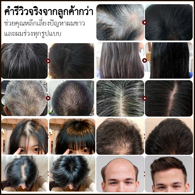 [แพ็คคู่] SAFEMILD แชมพูป้องกันผมร่วง ครีมนวดผม ส่งเสริมการเจริญเติบโตของเส้นผม + ซ่อมแซมความเสียหายของเส้นผม ปกป้องสีผม - รูปที่ 3