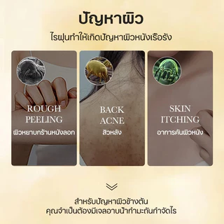 เจลอาบน้ำป้องกันไรฝุ่นกำมะถัน ครีมอาบน้ําลดสิว 500ml กำจัดไรลดสิว แก้คัน ลดการสะสมของแบคทีเรีย 99.8% ลดสิวที่หลัง