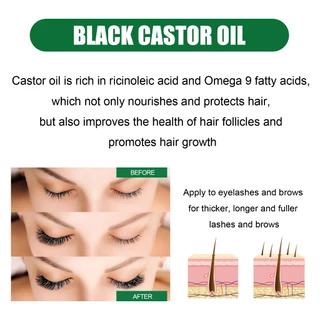OUHOE น้ำมันละหุ่ง castor oil 100% น้ำมันละหุ่งดำ เซรั่มปลูกผมดก เร่งผมยาว ขนตายาว ขนตาหนา ใช้ได้ทั้งผม ขนตา คิ้ว