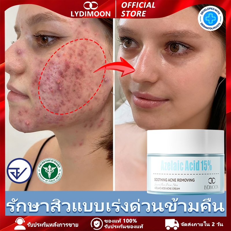 ครีมแต้มสิว Azelaic Acid สำหรับสิว รูขุมขนอุดตัน สิวหัวขาว และสิวหัวดำ ปลอบประโลมและฟื้นฟูผิว 30 g