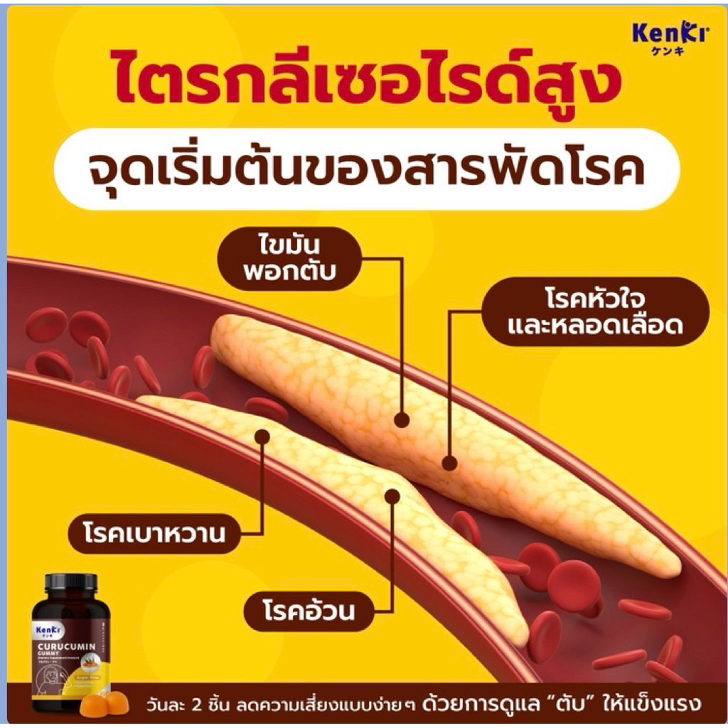 KENKI CURUCUMIN GUMMY และ KENKI CURUCUMIN PLUS GUMMY เก็นคิ คุรุคุมิน กัมมี่ อาหารเสริมในรูปแบบกัมมี่ ราคา ถูกที่สุด ดีลบีเคเค แกลเลอรีภาพที่ 3