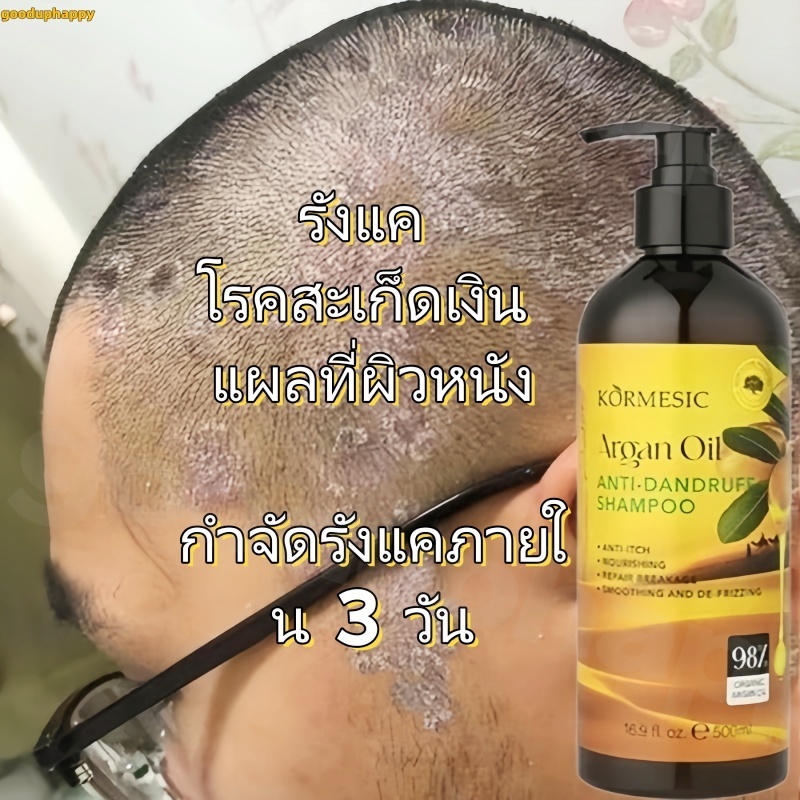แชมพูอาร์แกนออยล์ ขจัดรังแค ลดอาการคัน และต้านเชื้อรา 500 มล. เหมาะสำหรับหนังศีรษะที่คัน แชมพูนี้ช่วยขจัดรังแค ควบคุมควา