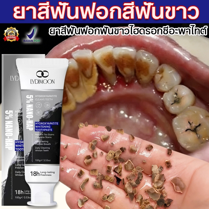 ยาสีฟันซ่อมแซมด้วยนาโนไฮดรอกซีอะพาไทต์ 5% ยาสีฟันฟันขาว ฟอกสีฟันขาว ช่วยลด หินปูน ฟันเหลือง ลดกลิ่นปาก 100g