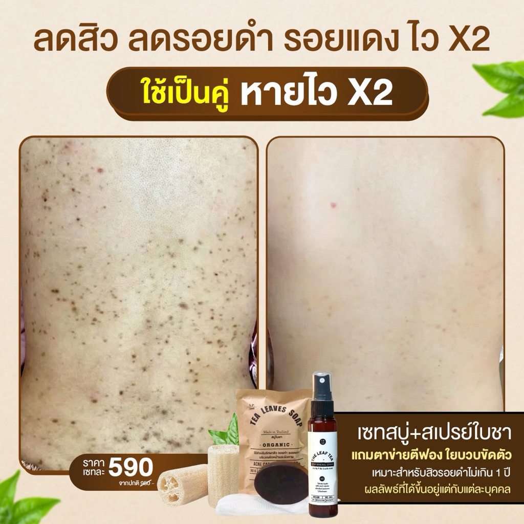 เซทสบู่สเปรย์ใบชาสูตรแพทย์แผนไทย แถมฟรีใยบวบขัดหลัง