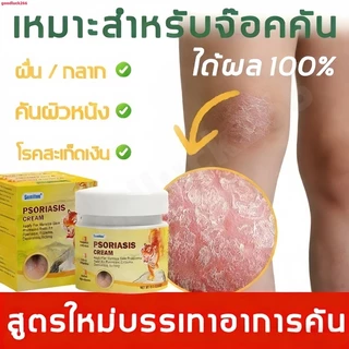 ครีมแก้คันขนาด 20 กรัมนี้ เหมาะสำหรับผิวแห้ง คัน และปัญหาผิวต่างๆ ผลิตจากสารสกัดจากพืช ปลอดภัยสำหรับผู้ที่เป็นโรคสะเก็ดเ