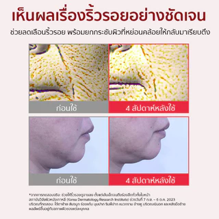[ 100% แท้ /พร้อมส่ง]Centellian24 Madeca Cream Time Reverse 50ml | ครีมตัวดังเกาหลี ย้อนวัยผิว ลดริ้วรอย กระชับรูขุมขน