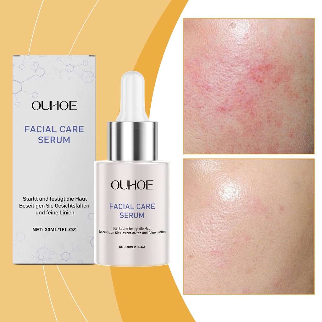 OUHOE เซรั่มไฮยา ชุ่มชื้น ลดริ้วรอย เซรั่มช่วยลดริ้วรอย Facial Serum บำรุงผิวโกลว์ เซรั่มหน้า เซรั่มบำรุงผิวหน้า