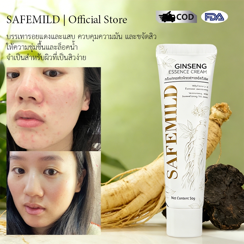 【เหมาะสำหรบผวแพงายและเปนสว】SAFEMILDครมเอสเซนส ชวยดแลปญหาสวอยางออนโยนไมระคายเคองไมทำใหผวแหงตง ลดสิว