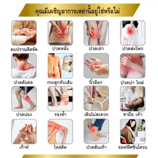 2 กล่อง [ส่งฟรี] อาหารเสริมสมุนไพรจีน ตรา ซึงเถี่ย บำรุงเส้นเอ้น เข่า ข้อ กระดูกทับเส้น