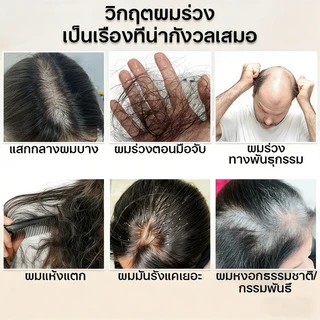 ✅SAFEMILD แชมพู สูตรเฮอร์บัล มายด์ ปิดผมหงอกอย่างมีประสิทธิภาพ ลดผมร่วง บำรุงและซ่อมแซมเส้นผม