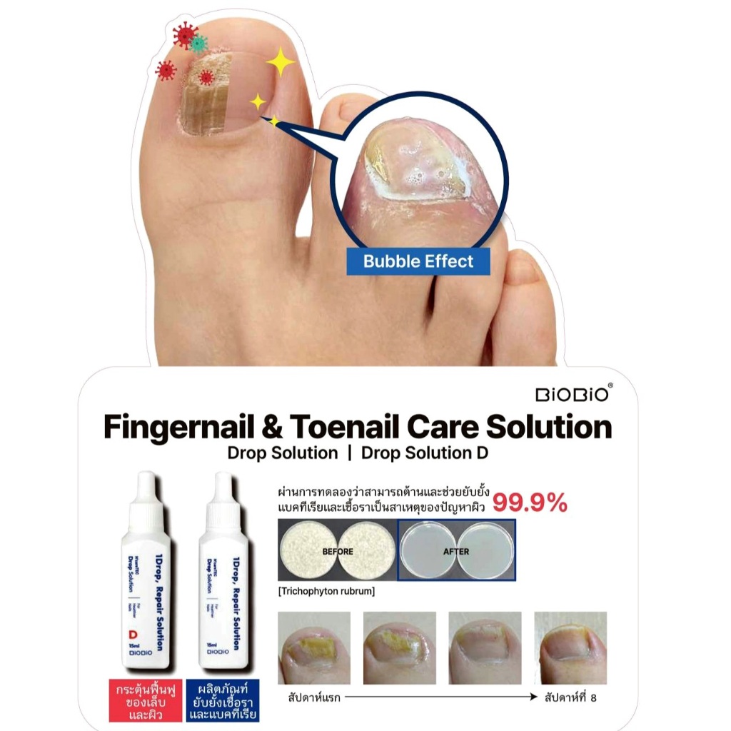 ผลิตภัณฑ์ขจัดเชื้อราที่เล็บ หลายตัวเลือก 🇰🇷Ncare 1Drop Solution🇰🇷FOO KEEPER 🦠