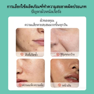 Dr.Lan โฟมล้างหน้า 100g ลดสิวอักเสบ Acne-Fighting Facial Cleanser คุมมันอ่อนโยนต่อผิวทำให้ผิวกระจ่างใสและกระชับขึ้น