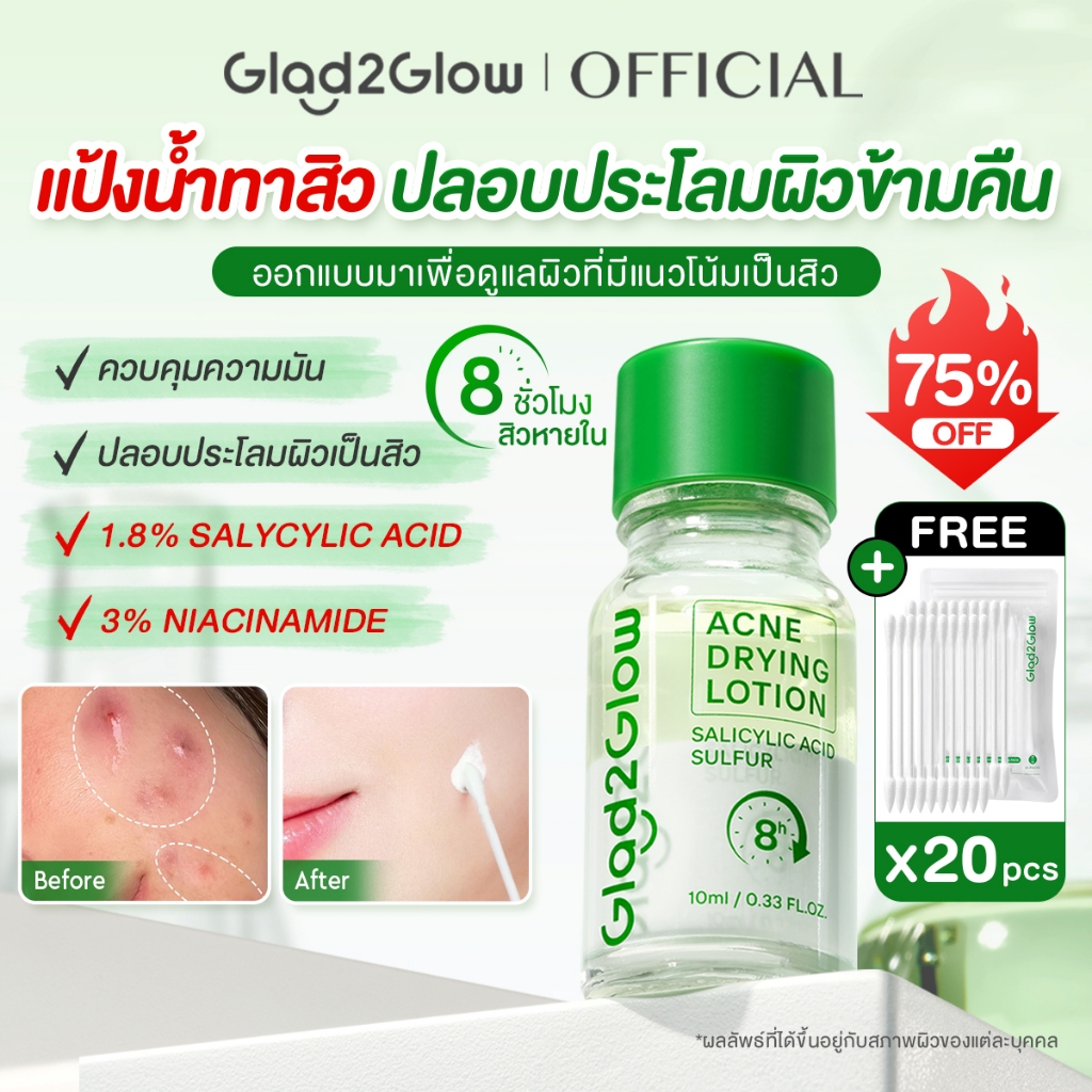 Glad2Glow Anti Acne Lotion Serum  ๘ ชั่วโมง เซรั่มลดสิว เจลแต้มสิว ลดรอยสิว ลดรอยแดง ลดการอักเสบ ที่ช่วยลดรูขุมขนและสิว