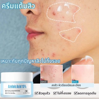 ครีมแต้มสิว ครีมสิว เจลแต้มสิว รักษาแต้มสิว รอยสิว ยุบไว สิว…