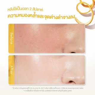 【Proxie's Pick】Glad2Glow VC Bright Glow Moisturizer วิตามินซี ไบรท์เทนนิ่ง มอยส์เจอร์ไรซิ่ง ครีมทาหน้า 50g
