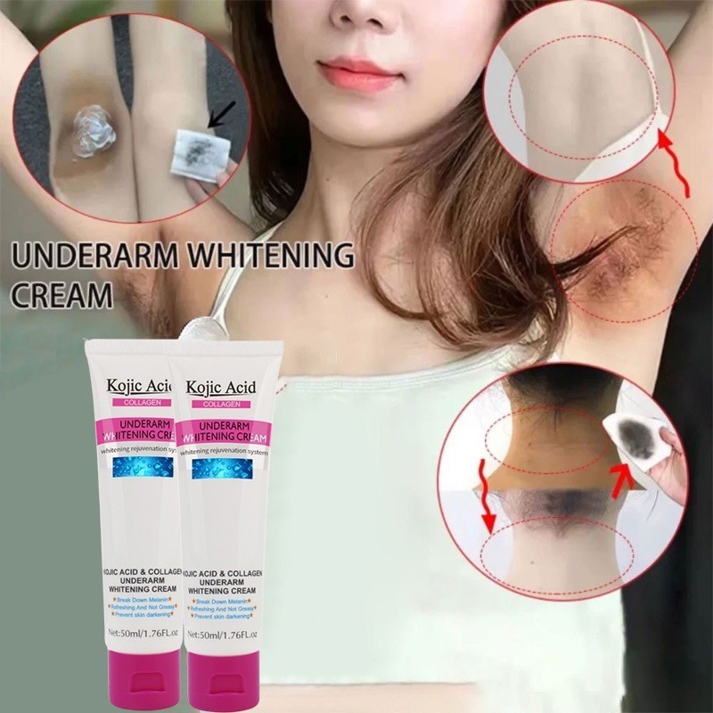 Kojic Acid ครีมขาหนีบดำ 50ml ครีมทารักแร้ขาว ครีมบำรุงรักแร้ เข่าดำ ผิวขาว สิ่งประดิษฐ์ ครีมขาหนีบดำ