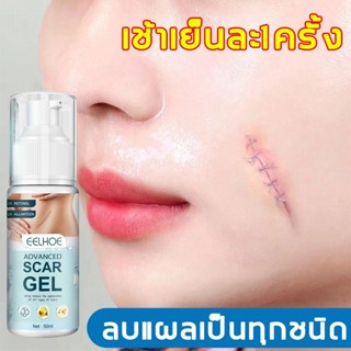 เจลทารอยแผลเป็น 50ml แผลเป็น ครีมเลือนรอยแผลเป็น เลือนแผลเป็…